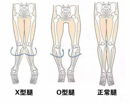 跷二郎腿的危害你知道吗?